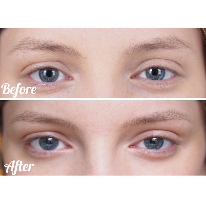 Face And Body Treading System